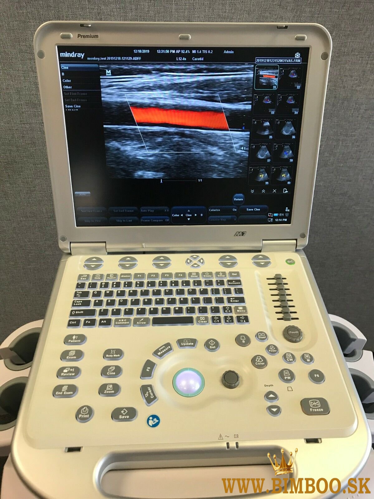 Mindray M7 Ultrasound Machine